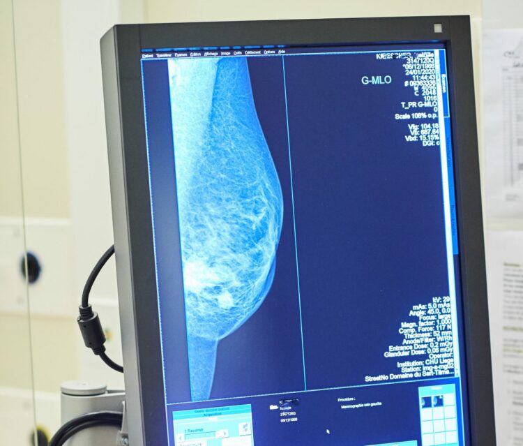 Tumore al seno: test genomici non ancora rimborsati
