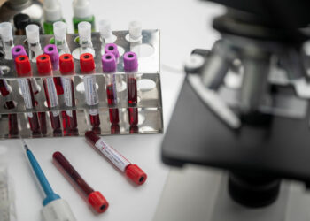 I guariti Covid devono fare il vaccino? quanto dura immunità?