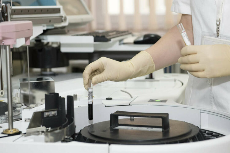 Lattoferrina, integratore alimentare contro il coronavirus