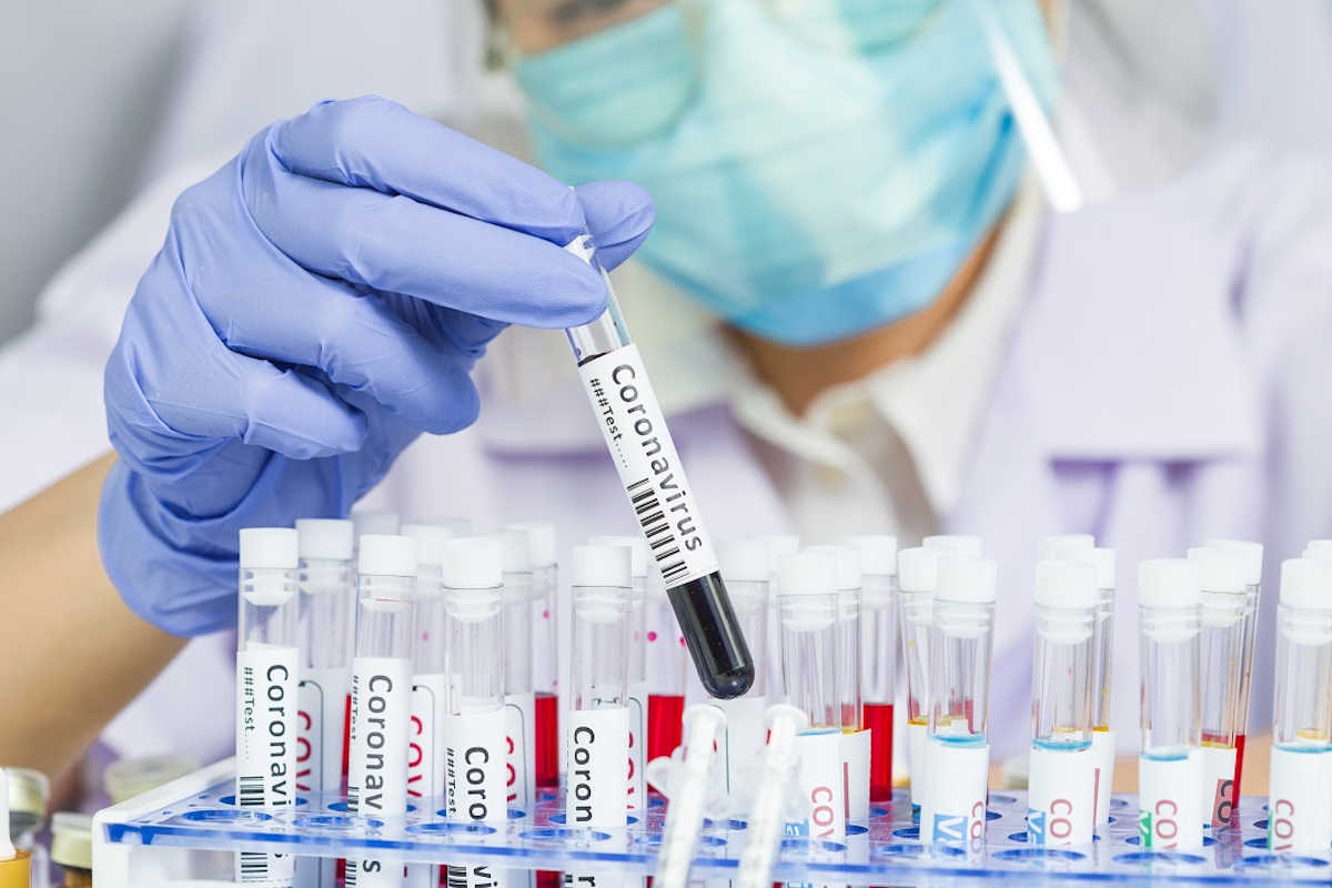 Covid Ragusa, 1.602 positivi e 2 morti: un uomo di Pozzallo e uno di Vittoria