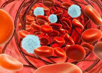 Leucemia linfatica cronica: benefici ibrutinib e monoterapia