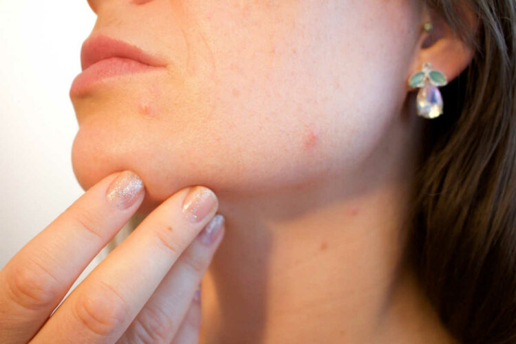Patata come rimedio naturale di benessere: ecco 5 usi e per cosa