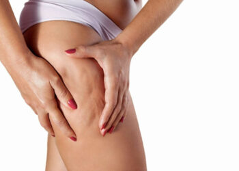 Ritenzione idrica, cosa mangiare contro la cellulite? Quale dieta seguire?