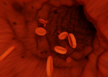 AstraZeneca, lieve rischio di sviluppare la porpora trombocitopenica: ecco cos'è