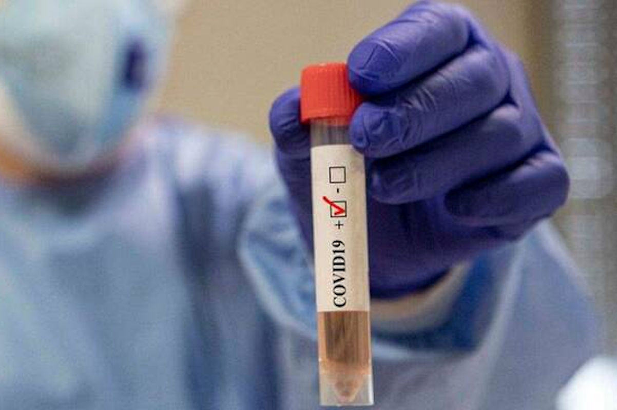 441 positivi Covid Ragusa: Comiso Comune con più contagi