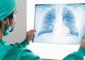 Polmonite da Covid: i polmoni a 6 mesi di distanza