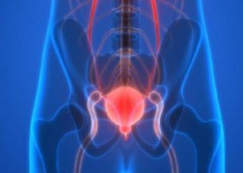 Carcinoma uroteliale, terapia con erdafinib e cetrelimab lo studio