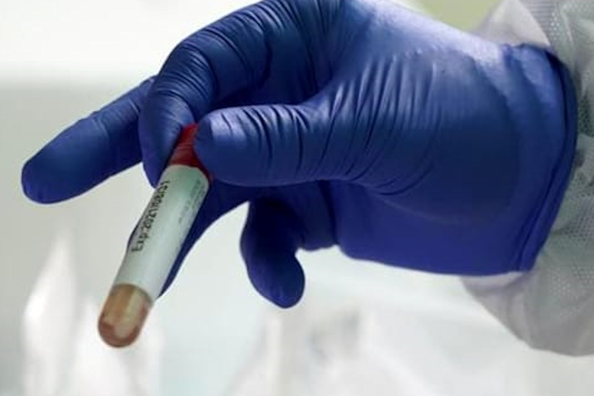 264 nuovi positivi Covid in Sicilia: 5 a Ragusa