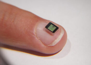 Retina bionica per 70enne cieco impiantata al Gemelli di Roma: dal buio alla luce