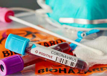 Covid Sicilia, 1.404 nuovi positivi: 290 a Catania e 21 a Ragusa