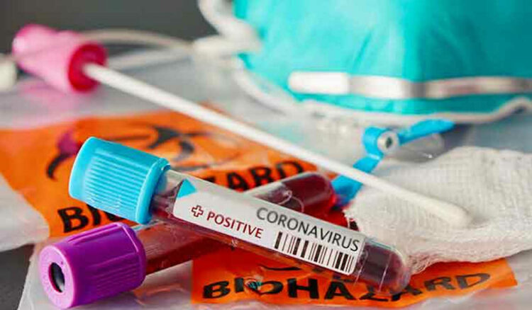 Covid Sicilia, 1.404 nuovi positivi: 290 a Catania e 21 a Ragusa