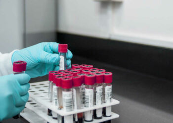 Covid, nuova variante IHU: isolata a Marsiglia