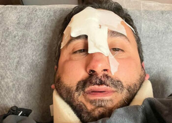 Lo chef della prova del Cuoco Natale Giunta i ospedale: cade con monopattino