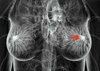 Asp Ragusa, ecco il numero da chiamare per prenotare la mammografia