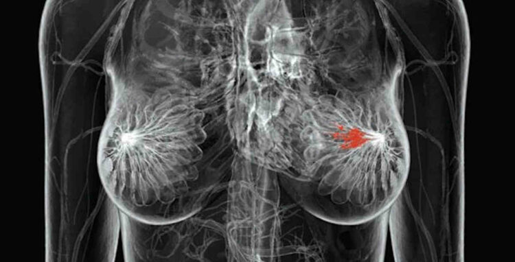 Asp Ragusa, ecco il numero da chiamare per prenotare la mammografia