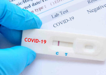 Asp Ragusa, fine isolamento Covid: basta fare un tampone antigenico rapido