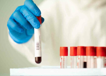 Covid Ragusa, 5.770 positivi: modicano muore in ospedale