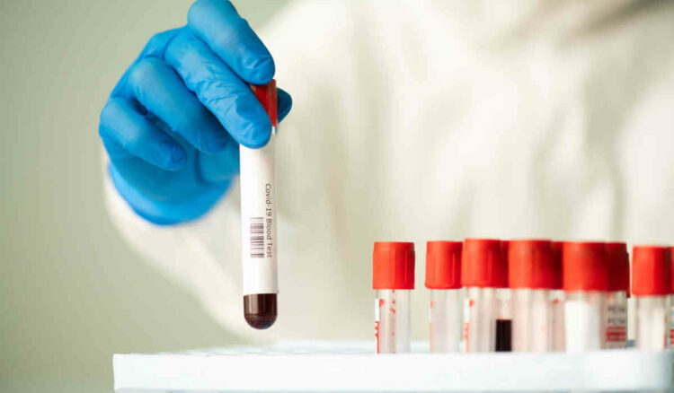 Covid Ragusa, 5.770 positivi: modicano muore in ospedale