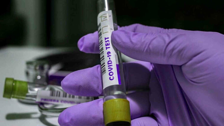 Covid Ragusa, 9253 positivi e 110 ricoverati