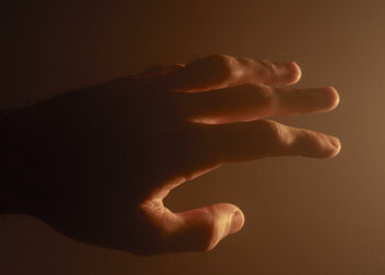 Perde un dito durante un furto e manda l'amico a cercarlo