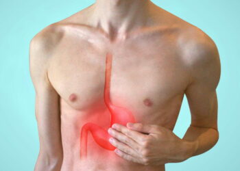 Gastrite, sintomi e dieta: cosa mangiare e cosa evitare