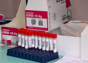 Covid Italia, 32.573 nuovi casi e 119 decessi