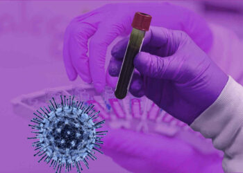 Covid Ragusa, 5121 positivi: ecco dove circola il virus