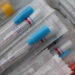 Omicron 2 più contagiosa, Lopalco: siamo a innesco quinta ondata Covid