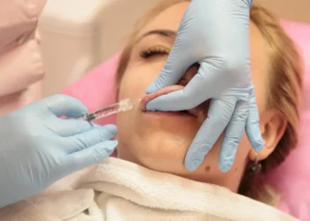 Medicina estetica, allarme filler fai da te: danni viso