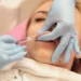 Medicina estetica, allarme filler fai da te: danni viso