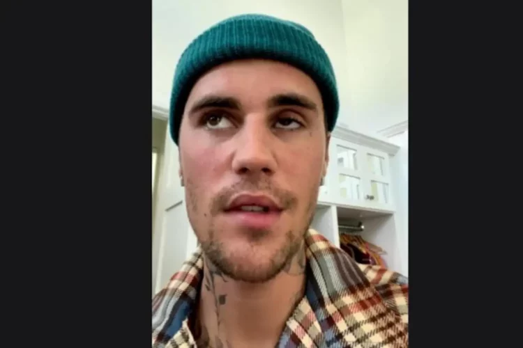 Justin Bieber colpito da paralisi al volto