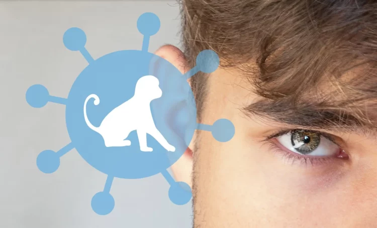 Vaiolo delle scimmie, 780 casi in 27 Paesi: sintomi e come si trasmette la malattia