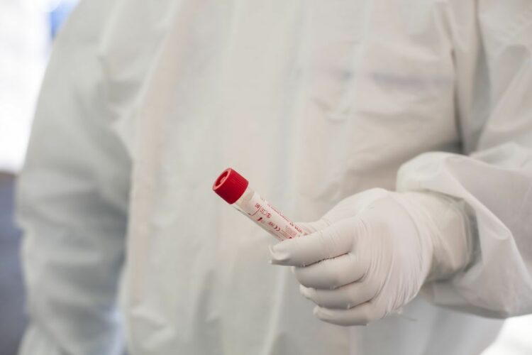 Covid, in Italia 84.700 casi e 63 morti in 24 ore