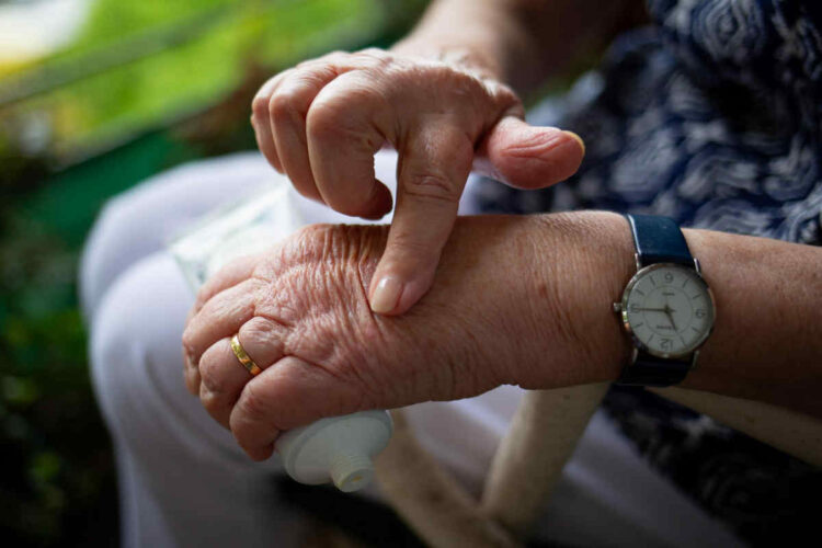Guselkumab in artrite psoriasica: cure per malattia
