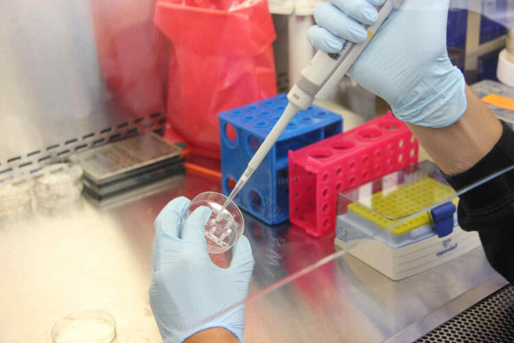 Ieo Milano, un test genico predice la recidiva del tumore al seno lobulare