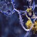 Alzheimer, Roche conferma il suo impegno in ricerca e sviluppo