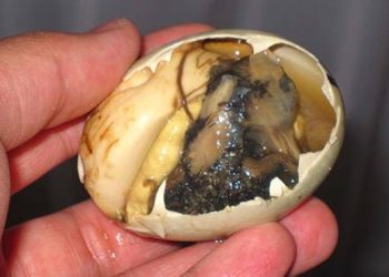 esofago ostruito da un uovo salvato a milano