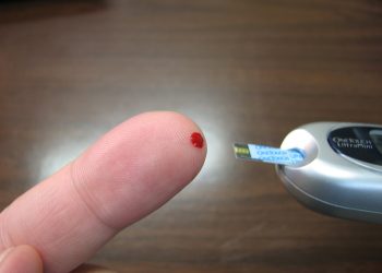 vivere con il diabete ipoglicemia cause sintomi