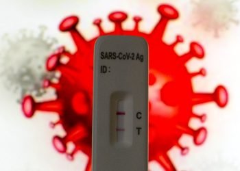 Covid, 33.876 nuovi casi positivi e 38 decessi