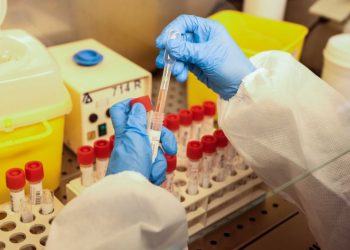 Covid, 48.714 nuovi casi e 120 decessi nelle ultime 24 ore