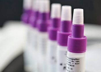 Covid Sicilia, 1.595 nuovi positivi: 87 a Ragusa