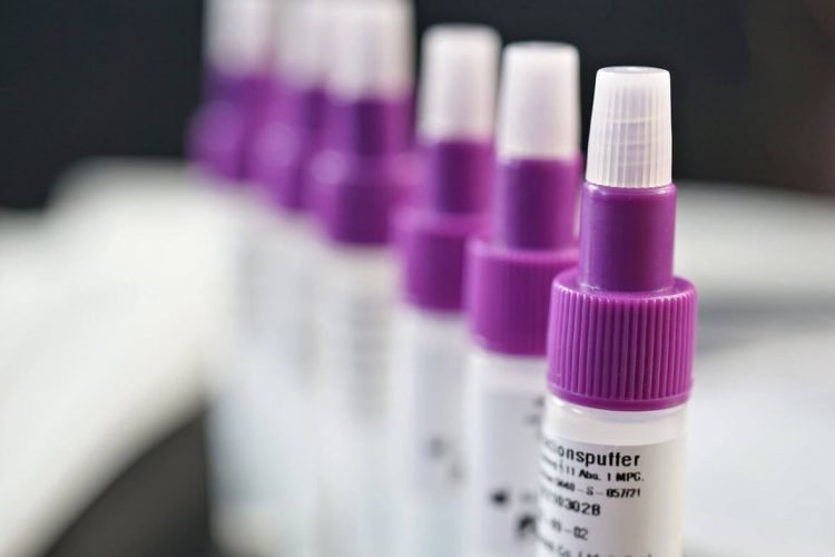 Covid Sicilia, 1.595 nuovi positivi: 87 a Ragusa