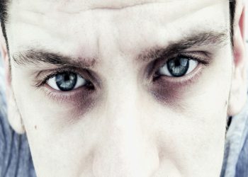 10 rimedi contro le occhiaie bluastre, grigie o viola