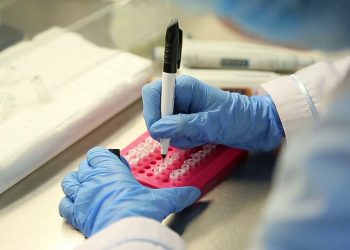 Nuova luce sulla distrofia di Duchenne