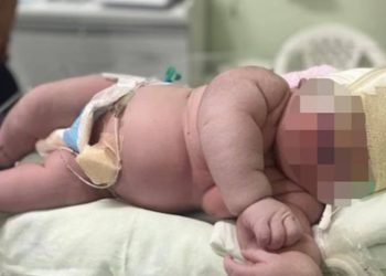 Parto record in Brasile: nato bimbo di oltre 7 chili ed è alto 60 centimetri. Il record 10 kg ad Aversa