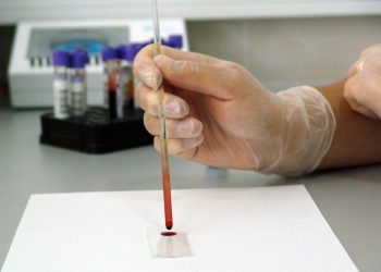 Malattie tropicali neglette in Italia, 4mila casi ogni anno: dalla dengue alla Chikungunya