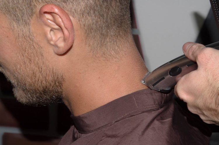 Allarme tigna in Spagna, contagi dai parrucchieri: cos'è, sintomi e come si trasmette