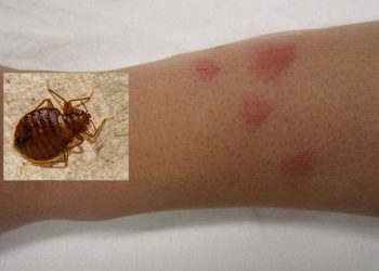 La cimice dei letti che popola le camere da letto