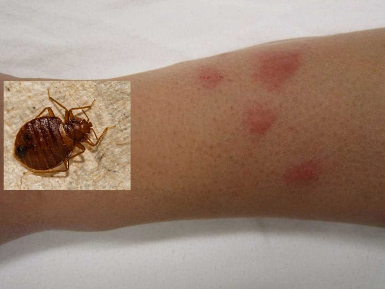 La cimice dei letti che popola le camere da letto