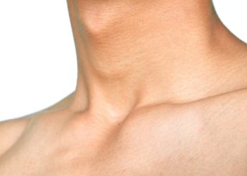 Faringite: cos'è, sintomi e rimedi naturali